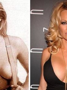 Celebs with the Worst Fake Breasts: Before and After 