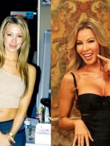 Lisa Hochstein Before and After Plastic Surgeries