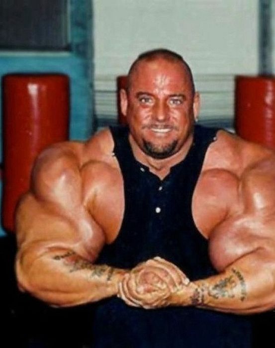 Another Synthol Victim 