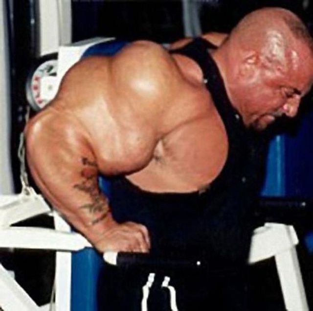 Another Synthol Victim 