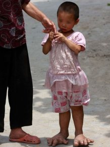 Chinese Girl with Giant Feet