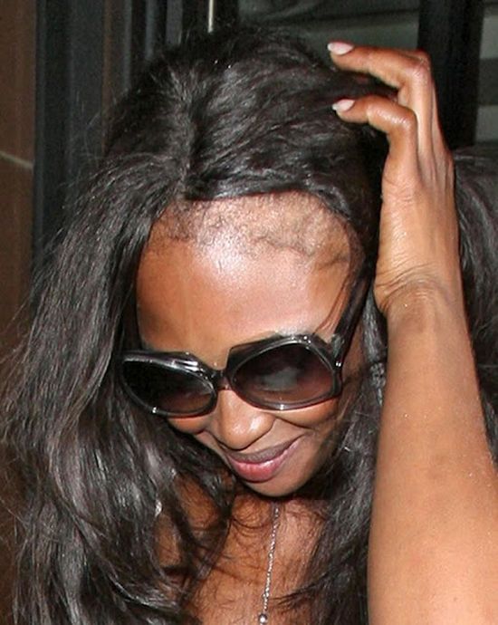 What Happened to Naomi Campbell' Hair?