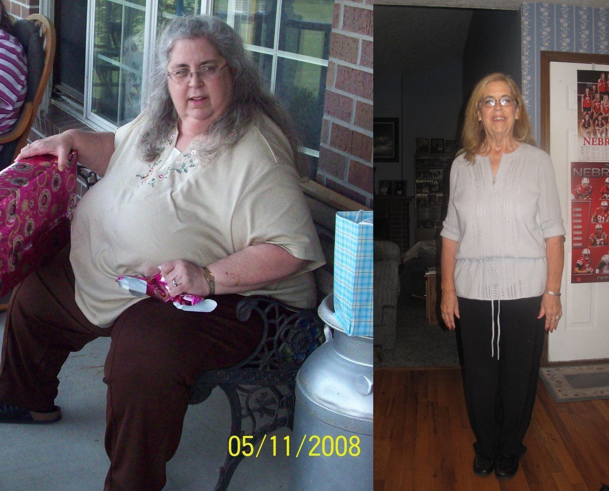 Вес после 60. Похудение до и после. Женшинипосли похудения.