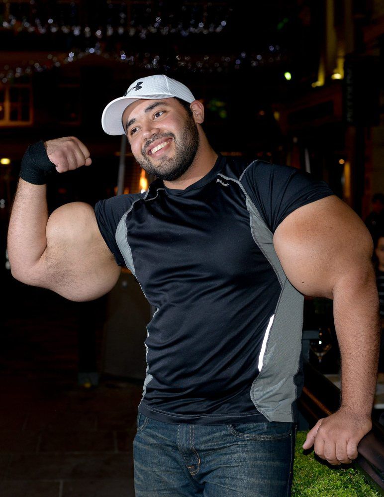 Egyptian Bodybuilder Has the Biggest Biceps in the World