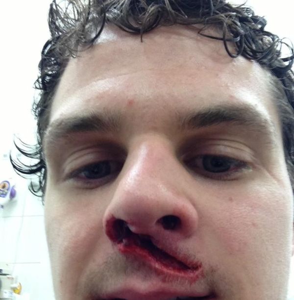 Hit by a Puck