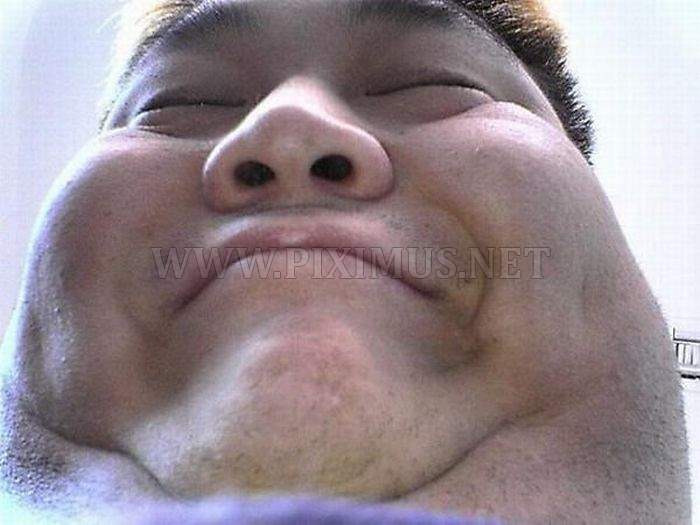 People with Double Chin
