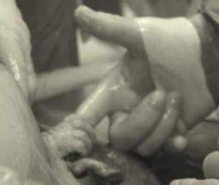 Handshake from the Womb