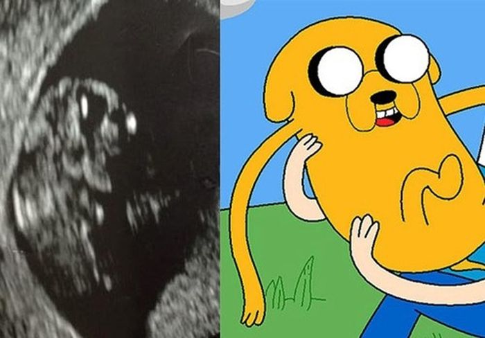 Babies in Ultrasound Who Look Like Fictional Characters