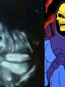Babies in Ultrasound Who Look Like Fictional Characters