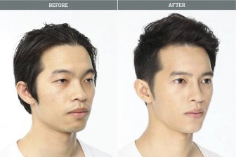 Korean Plastic Surgery