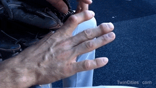 Athletes with Deformed Fingers