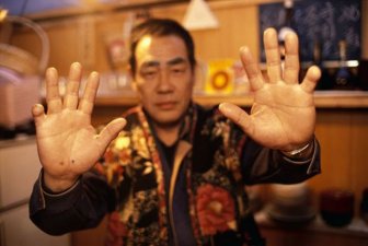 Prosthetic Pinkies for the Yakuza