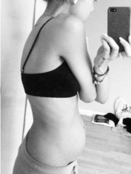 Anorexic Pregnant Girl