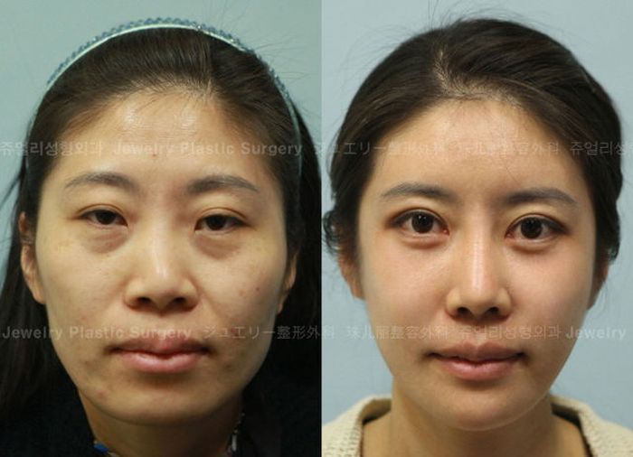 Korean Plastic Surgery, part 2