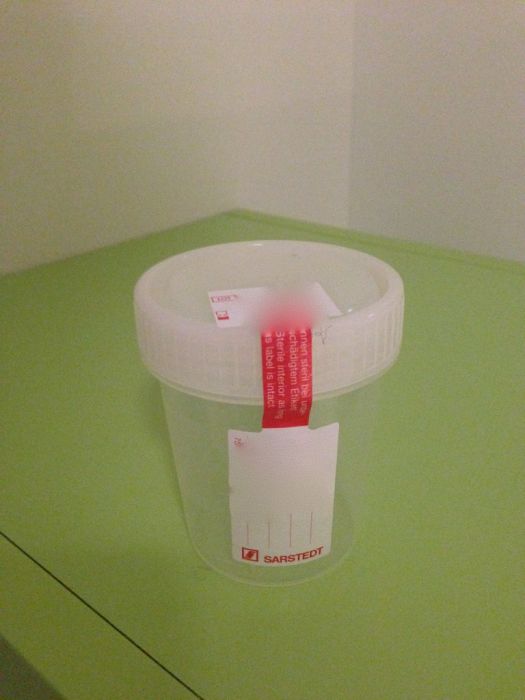 Giving a Sperm Sample in Sweden