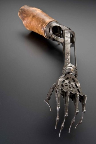 Artificial Arm from the Past