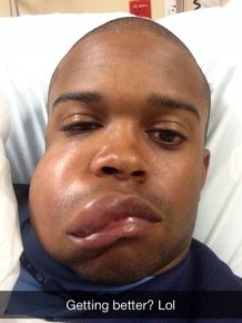 MLB Player Delino DeShields Jr Gets Hit in the Face