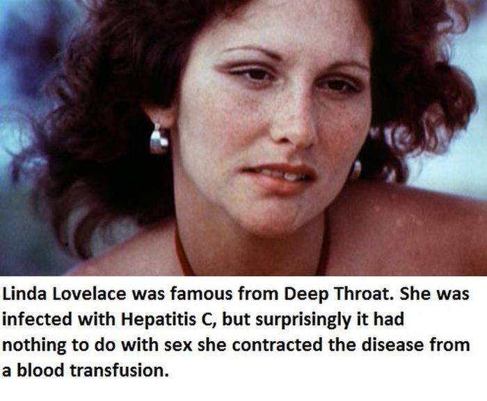 Celebrities You Didn't Know Have STDs