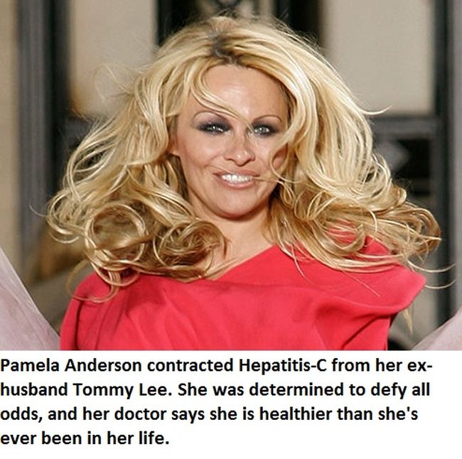 Celebrities You Didn't Know Have STDs