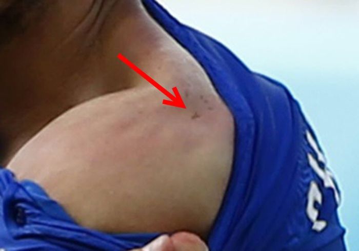 Luis Suarez Bites Another Player At The World Cup