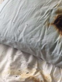 Samsung Phone Catches On Fire Under A Pillow