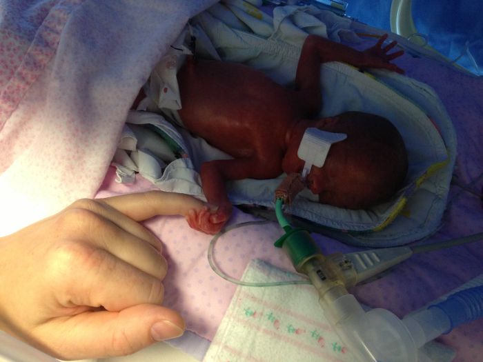 Baby Is Born 16 Weeks Early