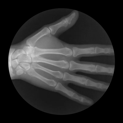 X-Ray GIFs That Show How Your Skeleton Works