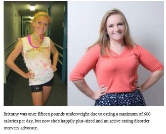 Inspiring Photos Of People Who Conquered Their Eating Disorders