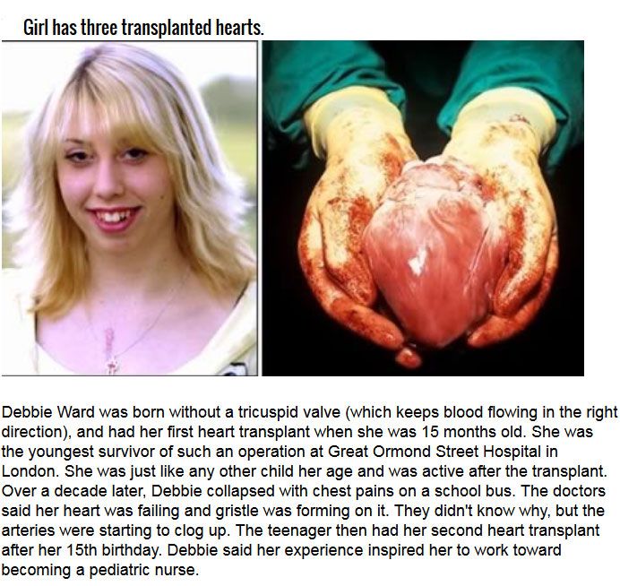 Strange Organ Transplant Stories From Around The World