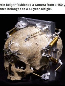 This Human Skull Is Now A Camera