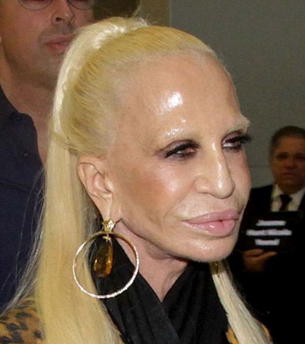 donatella versace - a before and after  Celebrity plastic surgery, Donatella  versace plastic surgery, Plastic surgery