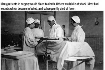 14 Bizarre Facts About Victorian Surgery