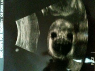 Ultrasounds That Look Like Nightmares Come To Life