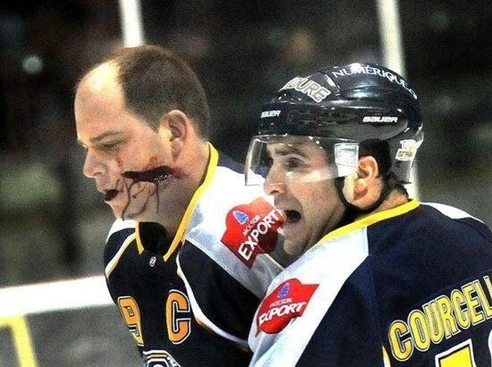 Sometimes Hockey Is More Violent Than MMA