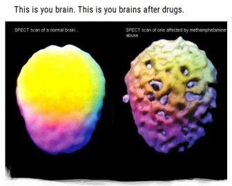 You Will Never Want To Do Drugs After Seeing These Photos