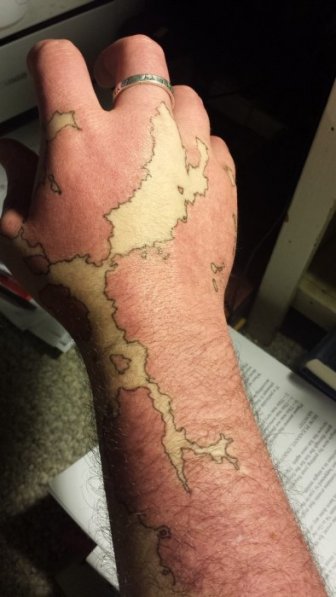 Man Transforms His Birthmark Into A Map Of A New World