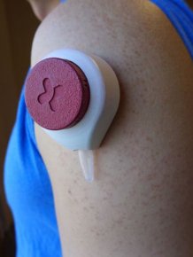 This Device Draws Blood Without Using A Needle