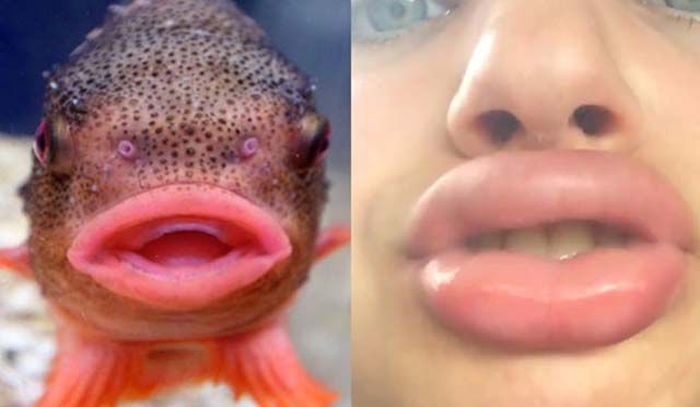 The Kylie Jenner Lip Challenge Continues To Give Girls Fish Lips