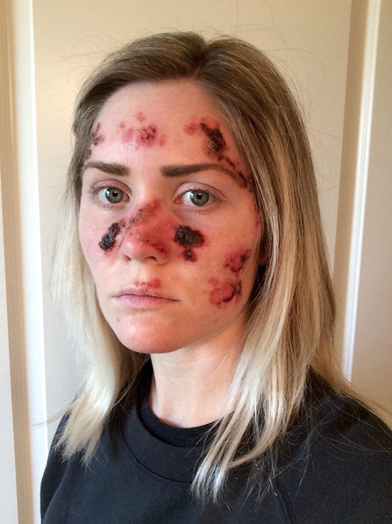 Woman Shows The Dangers Of Tanning With Graphic Selfie