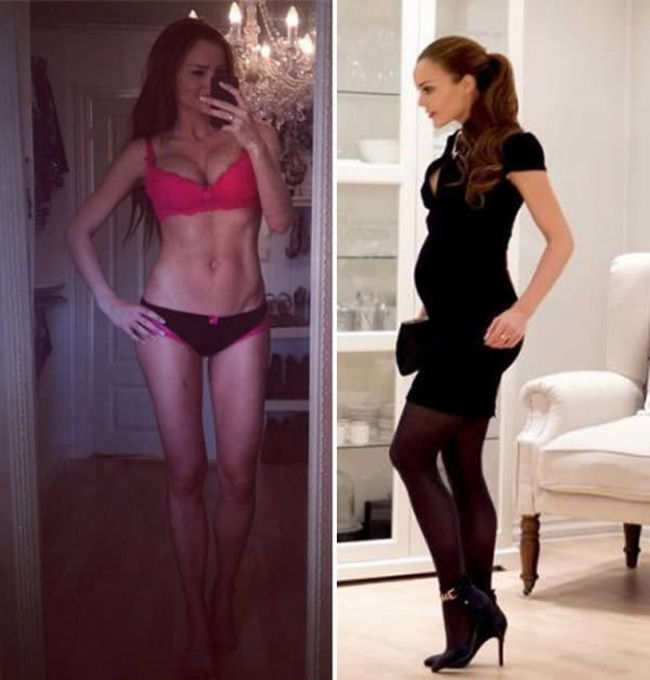 Hot Post-Pregnancy Bodies That Caused An Uproar