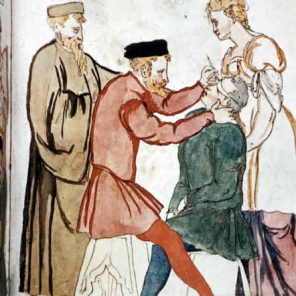 Bizarre Medical Devices That Were Used During Medieval Times
