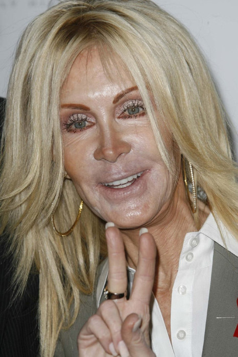 Plastic Surgery Gone Wrong, part 2