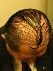Funniest Comb-Overs