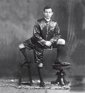 Francesco Lentini, a Man with Three Legs 