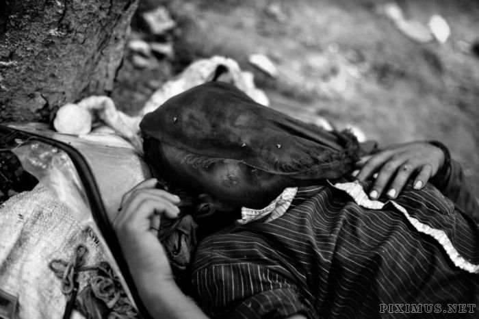 Heroin Addicts of India 
