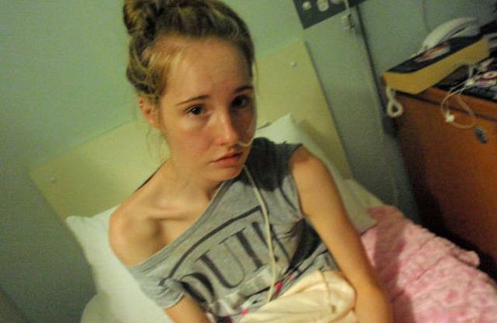 Girl Makes Amazing Recovery After Almost Losing Her Life To Anorexia