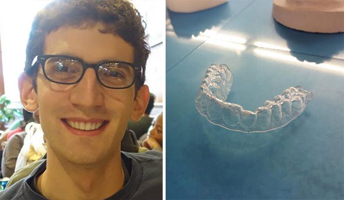 College Student Saves Thousands Of Dollars By 3D Printing His Own Braces
