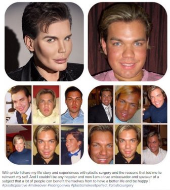 This Guy Really Messed Up His Face While Turning Himself Into A Human Ken Doll