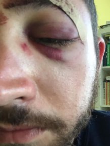 Shia LeBeouf Reaches Out To His Doppelganger Who Got Punched In The Face