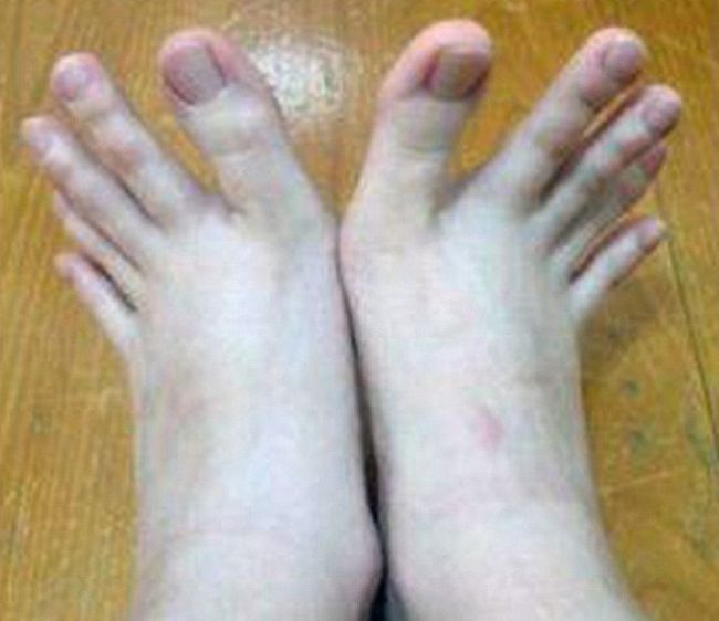 Can You Tell Which Ones Are Fingers And Which Ones Are Toes?